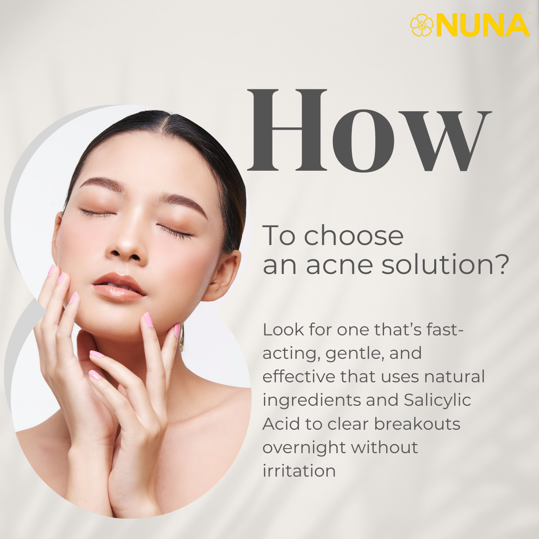 Nuna Pro Acne Solution